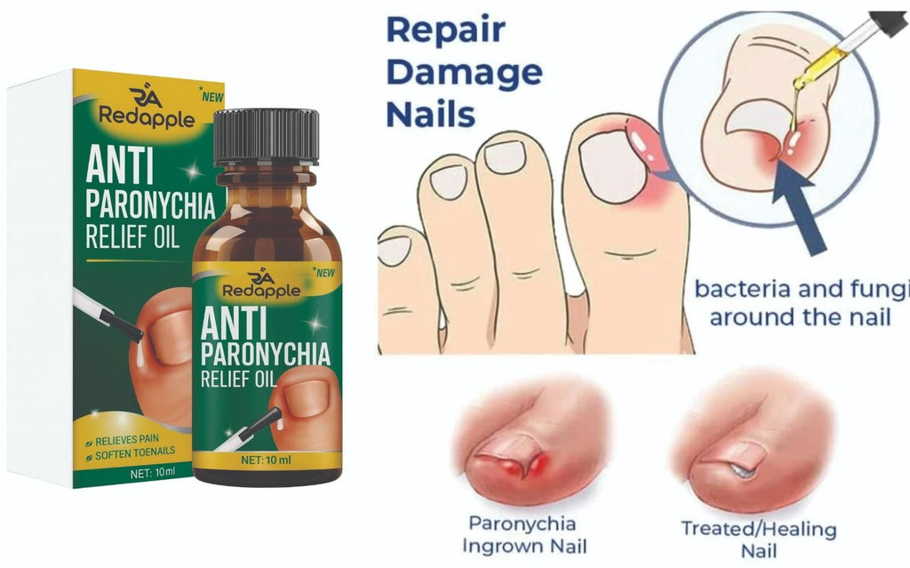 Anti Paronychia Relief Oil 10 ml Pack of 1 i6r2ja-hp